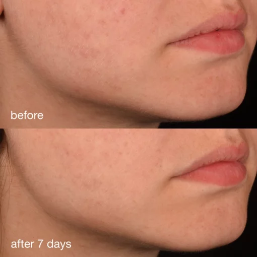 Dermalogica Pro-Collagen Banking Serum, 30 мл - Антиоксидантная сыворотка с коллагеном